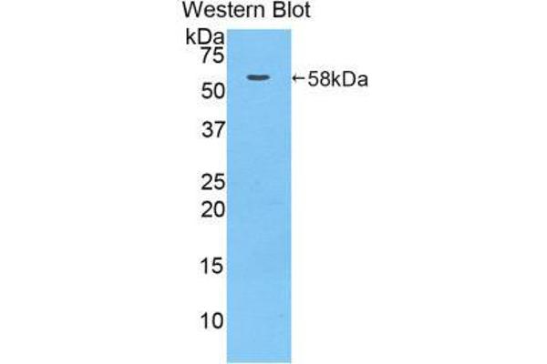 MACC1 Antikörper  (AA 522-784)