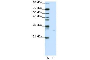 PDCD8 antibody used at 0. (AIF Antikörper  (C-Term))