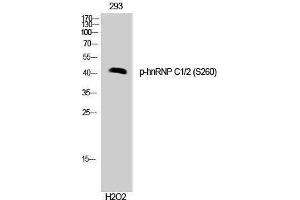 Western Blotting (WB) image for anti-Heterogeneous Nuclear Ribonucleoprotein C (C1/C2) (HNRNPC) (pSer260) antibody (ABIN3173285) (HNRNPC Antikörper  (pSer260))