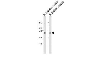 All lanes : Anti-MYL1 Antibody (N-Term) at 1:2000 dilution Lane 1: Human skeletal muslce lysate Lane 2: Rat skeletal muscle lysate Lysates/proteins at 20 μg per lane. (MYL1 Antikörper  (AA 24-58))