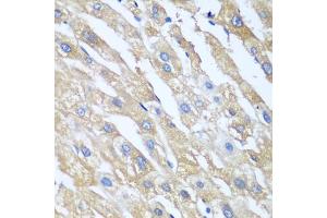 Immunohistochemistry of paraffin-embedded human liver using PPP4R1 antibody (ABIN5974671) at dilution of 1/100 (40x lens). (PPP4R1 Antikörper)