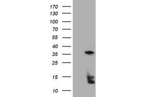 Image no. 5 for anti-Thymidylate Synthetase (TYMS) antibody (ABIN1501591) (TYMS Antikörper)