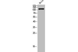 Western Blot analysis of HeLa cells using Na+/K+-ATPase α1 Polyclonal Antibody (TNNI3 Antikörper)