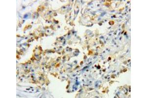Used in DAB staining on fromalin fixed paraffin-embedded lung tissue (Catalase Antikörper  (AA 10-507))