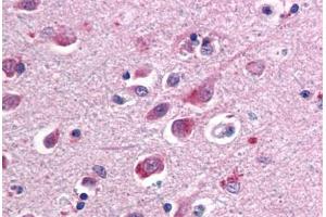 Human Brain, Cortex (formalin-fixed, paraffin-embedded) stained with SARM1 antibody ABIN461750 at 10 ug/ml followed by biotinylated anti-mouse IgG secondary antibody ABIN481714, alkaline phosphatase-streptavidin and chromogen. (SARM1 Antikörper  (AA 93-292))