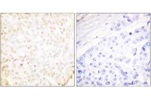 Immunohistochemistry (IHC) image for anti-X-Ray Repair Complementing Defective Repair in Chinese Hamster Cells 5 (Double-Strand-Break Rejoining) (XRCC5) (AA 683-732) antibody (ABIN2889296) (XRCC5 Antikörper  (AA 683-732))