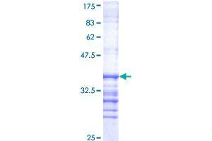 Image no. 1 for Dual-Specificity tyrosine-(Y)-phosphorylation Regulated Kinase 1A (DYRK1A) (AA 674-763) protein (GST tag) (ABIN1352200) (DYRK1A Protein (AA 674-763) (GST tag))