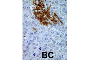 Immunohistochemistry (IHC) image for anti-Pregnancy Up-Regulated Non-Ubiquitously Expressed CaM Kinase (PNCK) antibody (ABIN3002987) (PNCK Antikörper)