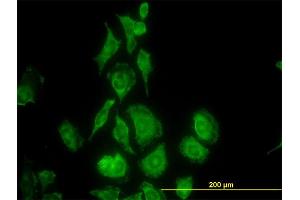 Immunofluorescence of monoclonal antibody to TIMP2 on HeLa cell. (TIMP2 Antikörper  (AA 27-220))