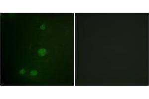 Immunofluorescence (IF) image for anti-Retinoblastoma Protein (Rb Protein) (AA 771-820) antibody (ABIN2888773) (Retinoblastoma Protein (Rb) Antikörper  (AA 771-820))