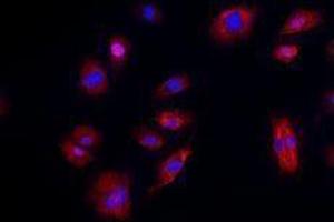 Immunofluorescence (IF) image for anti-Cadherin 5 (CDH5) antibody (Alexa Fluor 594) (ABIN2656818) (Cadherin 5 Antikörper  (Alexa Fluor 594))