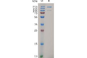 Human I, His Tag on SDS-PAGE under reducing condition. (ITGA2 Protein (AA 30-1132) (His tag))