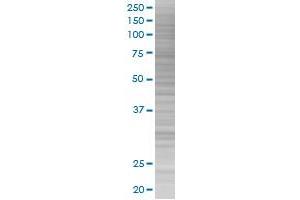 EEF1E1 transfected lysate. (EEF1E1 293T Cell Transient Overexpression Lysate(Denatured))