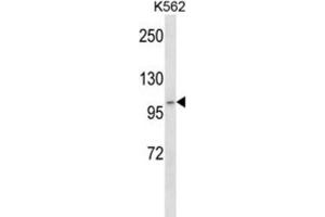 Western Blotting (WB) image for anti-ADAM Metallopeptidase with thrombospondin Type 1 Motif, 5 (ADAMTS5) antibody (ABIN2997573) (ADAMTS5 Antikörper)