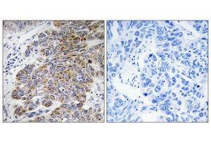 Immunohistochemistry (IHC) image for anti-Carbohydrate Sulfotransferase 10 (CHST10) (Internal Region) antibody (ABIN1850990) (CHST10 Antikörper  (Internal Region))