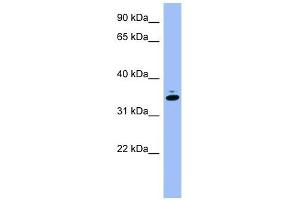 GAPDH antibody used at 1 ug/ml to detect target protein. (GAPDH Antikörper  (Middle Region))