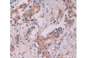 Used in DAB staining on fromalin fixed paraffin- embedded Kidney tissue (STAT5A Antikörper  (AA 586-688))
