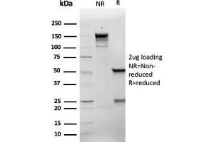 SDS-PAGE Analysis Purified p21 Recombinant Mouse Monoclonal Antibody (rCIP1/6907). (Rekombinanter p21 Antikörper  (AA 1-100))