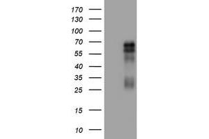 Image no. 1 for anti-Tumor Necrosis Factor Receptor Superfamily, Member 8 (TNFRSF8) (AA 19-379) antibody (ABIN1491091) (TNFRSF8 Antikörper  (AA 19-379))