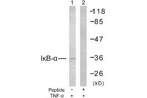 Western Blotting (WB) image for anti-Nuclear Factor of kappa Light Polypeptide Gene Enhancer in B-Cells Inhibitor, alpha (NFKBIA) (Ser32), (Ser36) antibody (ABIN1848117) (NFKBIA Antikörper  (Ser32, Ser36))
