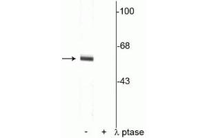 Western blot of rat cortical lysate showing specific immunolabeling of the ~62 kDa synaptotagmin phosphorylated at Thr202 in the first lane (-). (SYT1 Antikörper  (pThr202))