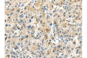 Immunohistochemistry (IHC) image for anti-TRAF Interacting Protein (TRAIP) antibody (ABIN5957748) (TRAIP Antikörper)