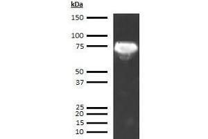 Western Blotting (WB) image for anti-alpha-Fetoprotein (AFP) antibody (ABIN613541) (alpha Fetoprotein Antikörper)