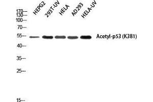 Western Blot (WB) analysis of HepG2 293T-UV HeLa AD293 HeLa-UV using Acetyl-p53 (K381) Polyclonal Antibody. (p53 Antikörper  (acLys381))