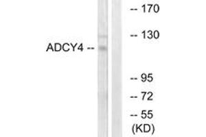 Western Blotting (WB) image for anti-Adenylate Cyclase 4 (ADCY4) (AA 195-244) antibody (ABIN2889852) (ADCY4 Antikörper  (AA 195-244))