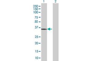 Lane 1: SULT1E1 transfected lysate ( 35. (SULT1E1 293T Cell Transient Overexpression Lysate(Denatured))