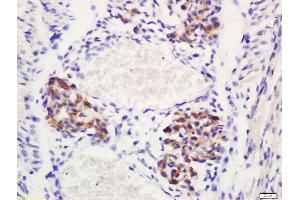 Formalin-fixed and paraffin embedded mouse emrbyo labeled with Rabbit Anti-Delta 4 Polyclonal Antibody, Unconjugated (ABIN761606) at 1:200 followed by conjugation to the secondary antibody and DAB staining (DLL4 Antikörper  (AA 551-650))