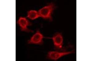 ABIN6266551 staining HuvEc by IF/ICC. (GRM7 Antikörper  (C-Term))