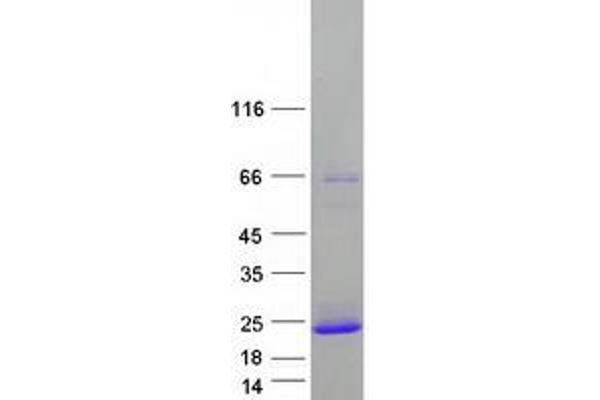 PRR4 Protein (Transcript Variant 2) (Myc-DYKDDDDK Tag)