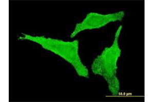 Immunofluorescence of monoclonal antibody to CDKL2 on HeLa cell. (CDKL2 Antikörper  (AA 394-493))