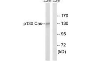 Western Blotting (WB) image for anti-Breast Cancer Anti-Estrogen Resistance 1 (BCAR1) (AA 376-425) antibody (ABIN2888602) (BCAR1 Antikörper  (AA 376-425))