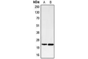 Western blot analysis of PUMA expression in K562 (A), U937 (B) whole cell lysates. (PUMA Antikörper  (C-Term))