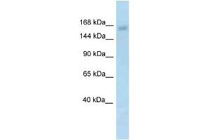 WB Suggested Anti-Utx Antibody   Titration: 1. (KDM6A Antikörper  (N-Term))
