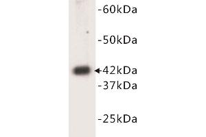 Western Blotting (WB) image for anti-Actin, Alpha, Cardiac Muscle 1 (ACTC1) (N-Term) antibody (ABIN1854823) (ACTC1 Antikörper  (N-Term))