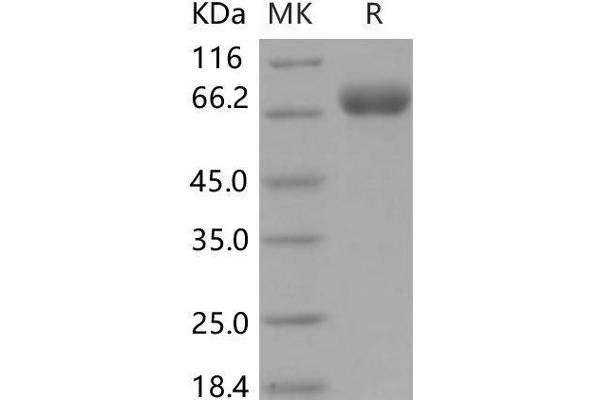 OPCML Protein (AA 1-541) (His tag)