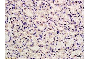 Immunohistochemistry (Paraffin-embedded Sections) (IHC (p)) image for anti-Protein tyrosine Phosphatase, Receptor Type, C (PTPRC) (AA 1210-1304) antibody (ABIN669606)