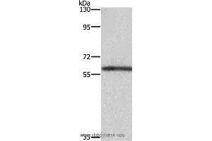 Western blot analysis of Mouse kidney tissue, using TBX5 Polyclonal Antibody at dilution of 1:350 (T-Box 5 Antikörper)