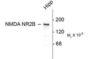 Image no. 1 for anti-Glutamate Receptor, Ionotropic, N-Methyl D-Aspartate 2B (GRIN2B) (C-Term) antibody (ABIN305791) (GRIN2B Antikörper  (C-Term))