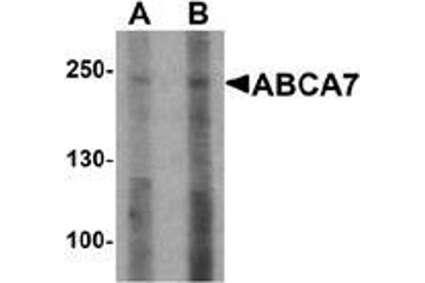ABCA7 Antikörper  (N-Term)