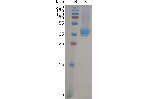 FCER2 Protein (AA 48-321) (His tag)