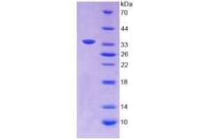 SDS-PAGE (SDS) image for Annexin A5 (ANXA5) ELISA Kit (ABIN6730890)