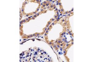 Immunohistochemical analysis of paraffin-embedded H. (AK4 Antikörper  (AA 119-153))