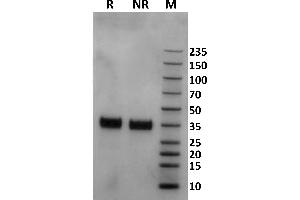 Human Fc gamma RIIa / CD32a (167R) protein on Coomassie Blue stained SDS-PAGE under non-reducing (NR) and reducing (R) conditions. (FCGR2A Protein (AA 36-218) (His-Avi Tag))