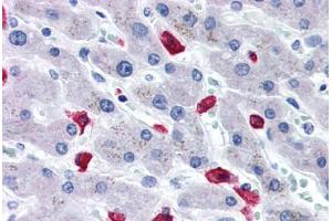 Human Liver (formalin-fixed, paraffin-embedded) stained with CD163 antibody ABIN337380 at 20 ug/ml followed by biotinylated goat anti-rabbit IgG secondary antibody ABIN481713, alkaline phosphatase-streptavidin and chromogen. (CD163 Antikörper  (N-Term))