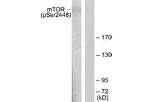 Western Blotting (WB) image for anti-Mechanistic Target of Rapamycin (serine/threonine Kinase) (mTOR) (pSer2448) antibody (ABIN2888475) (MTOR Antikörper  (pSer2448))