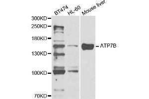 Western Blotting (WB) image for anti-ATPase, Cu++ Transporting, beta Polypeptide (ATP7B) antibody (ABIN1876877) (ATP7B Antikörper)